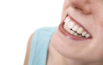 Zahnersatz, gesunde Zähne, Lächeln